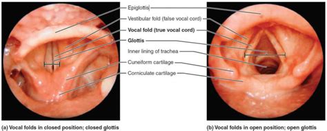 omega shaped epiglottis|should the epiglottis be visible.